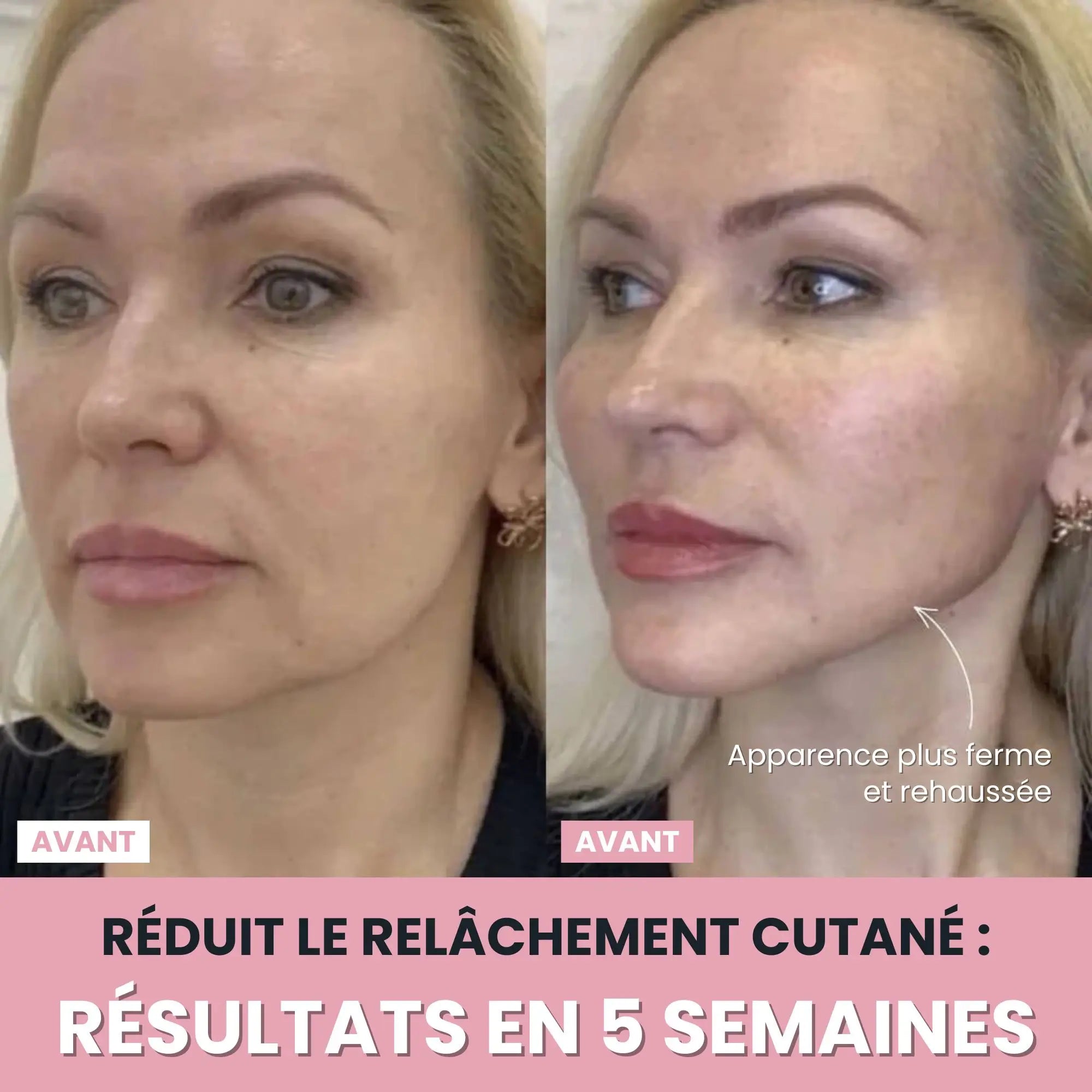 Alesia Sculteur facial LED 7 en 1