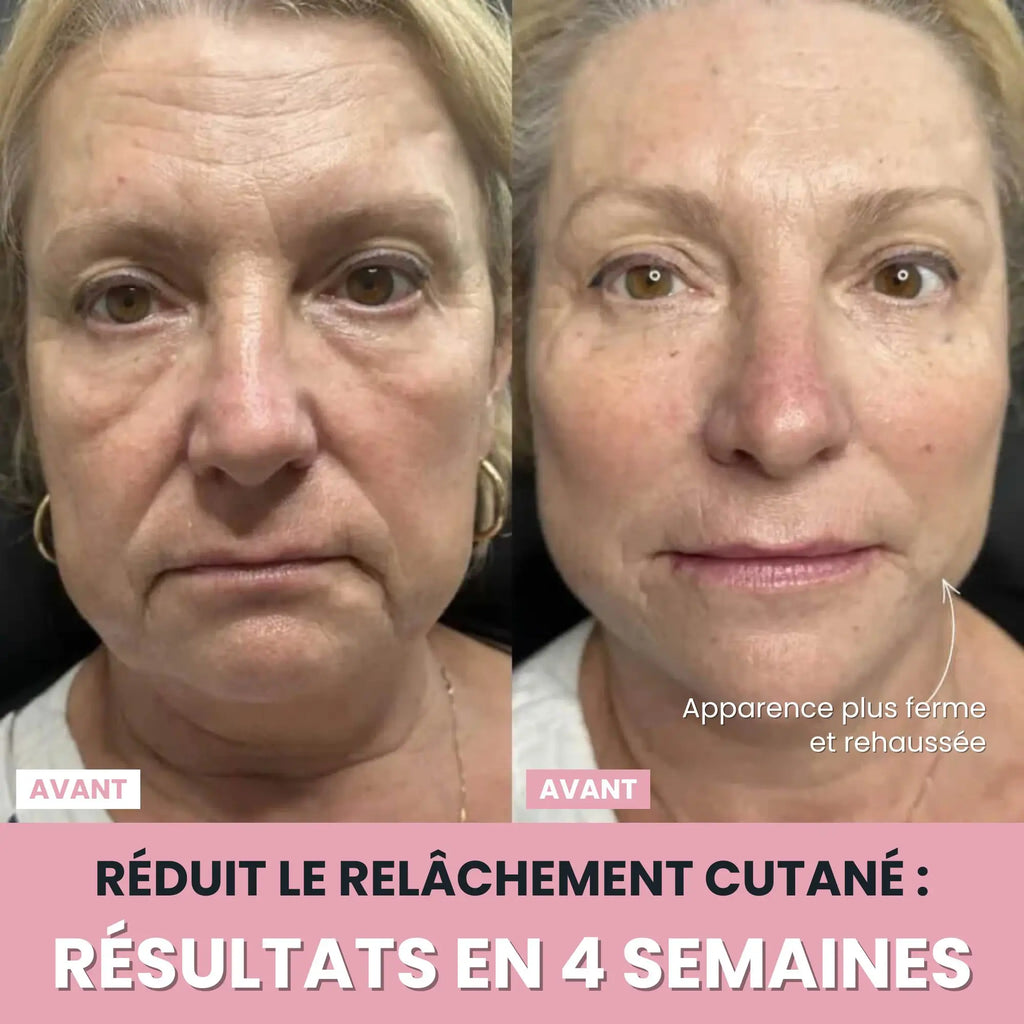 Alesia Sculteur facial LED 7 en 1