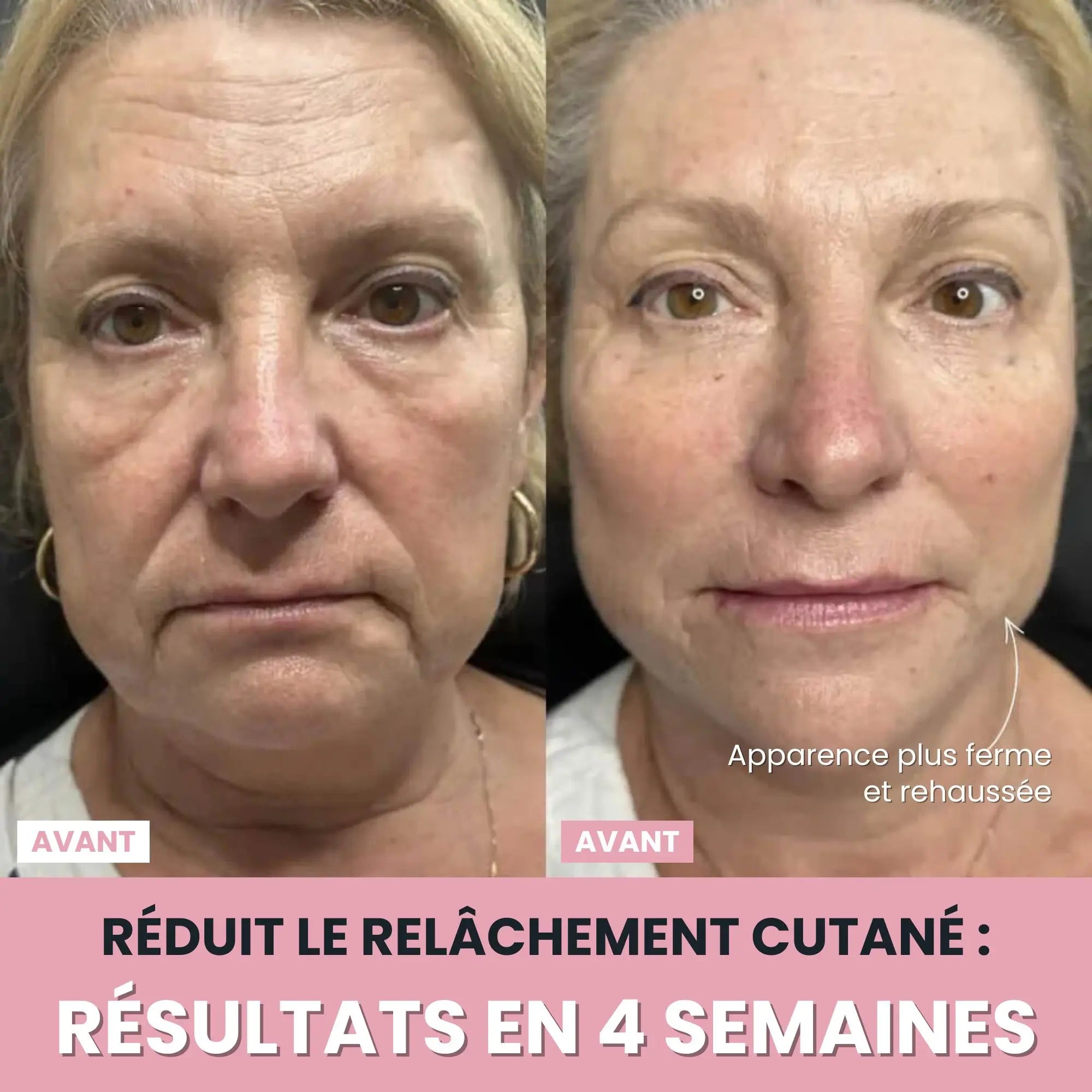 Alesia Sculteur facial LED 7 en 1